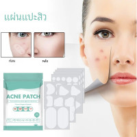 ราคา แผ่นมาส์กหน้ารักษาสิวแผ่นแปะรักษาสิวรอยสิวเพื่อรักษาสิวที่ไม่ระคายเคืองและอ่อนโยน (21431030586)