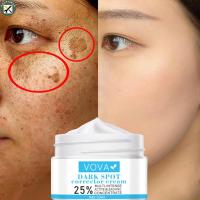 ราคา BouPower Whitening Freckle Cream Remove Melasma Acne Spot Pigment Melanin Dark Spots Pigmentation Moisturizing Gel Skin Care (20110670192)