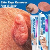 ราคา ครีมทาไฝหูด ติ่งเนื้อ ตาปลา กระ ทาหูดไฝได้ทั้งร่างกายทั่วตัว ไฝ ขี้แมลงวัน น้ำในเท้า หนังลอก (21785943277)