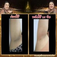 ราคา เซรั่มรักแร้ เซรั่มตรีชฎา บำรุงผิวใต้วงแขน ระงับกลิ่นกาย ซอง (20582309376)
