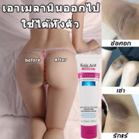 ราคา ครีมทารักแร้ขาว ครีมทาขาหนีบดำ 50 ml Kojic Acid Collagen Underarm Whitening Cream ครีมบำรุงรักแร้ ครีมทาขาหนีบ ครีมทาใต้วงแขน ครีมเข่าขาว ครีมขาขาว (18133879065)