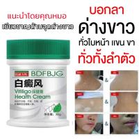ราคา โรคด่างขาว ด่างขาว ครีมทาด่างขาว Vitiligo 30g กำจัดด่างขาวอย่างรวดเร็ว สีผิวไม่เสมอ สารสกัดจากสมุนไพร ส่วนผสมอ่อนโยน (21644153224)