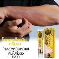 ราคา ครีมยา สะเก็ดเงิน กลาก ครีมลดอาการคัน แก้คัน ยาทาแก้เชื้อรา กลากเกลื้อน โรคผิวหนัง สารสกัดจากพืช ใช้ได้ทั้งตัว (20293376547)