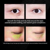 ราคา การส่งมอบกรุงเทพฯ OCX ครีมลดถุงใต้ตา เมจิกอายครีม 20ml ครีมถุงใต้ตา ครีมทาถุงใต้ตา ถุงใต้ตาบวม ครีมทารอบดวงตา กระชับ ยกกระชับ อายครีมลดใต้ตา eye cream (21829818305)