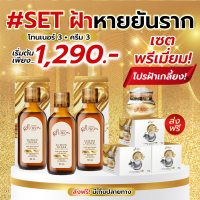 ราคา SUWON TONER โทนเนอร์ และ ครีม CREAM ซูวอน ครีมฝ้า กระ ผิวหน้า ฝ้า ขาวใส ผิวเรียบ เนียน ลด สิว ฝ้า (21300600711)