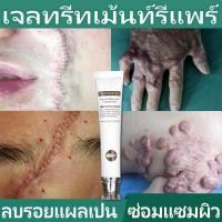 ราคา Vibrant Glamour ครีมลบแผลเป็น ครีมลบรอยแผลเป็น ครีมทาแผลเป็น ครีมรักษาแผลเป็น ลดรอยไหม้ น้ำร้อนลวก แผลผ่าตัด และรอยแผลเป็นอื่นๆ (17572830735)