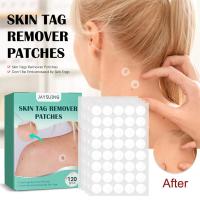 ราคา หูด Remover พลาสเตอร์ผิวแท็ก Remover หูดรักษาแพทช์สมุนไพรสารสกัดจากเท้าข้าวโพดพลาสเตอร์สิวหูดสติกเกอร์ (15659576670)