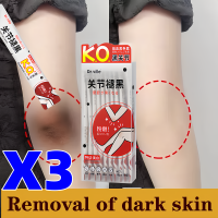 ราคา พร้อมส่งจากไทยทันที ใช้ได้กับทุกข้อต่อของร่างกาย ครีมทาก้นดำลาย ครีมบำรุงรักแร้ ครีมเข่าขาว ครีมขาขาว ครีมทาขาหนีบดำ ครีมทาคอดำ ครีมทาขาหนีบ ครีมทารักแร้ขาว ครีมทาตูดดำ ยาทาขาหนีบ ครีมทาก้นขาว ครีมขา 