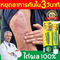 ราคา ครีมลดอาการคัน ทาแก้คัน ผิวหนังทากากเกลื้อน สะเก็ดเงิน กลาก ครีมลดอาการคัน (22149317119)