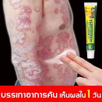 ราคา ยาทาแก้คัน แก้คัน ตุ่มเหงื่อ ผื่นผิวหนัง อับชื้น ผด ครีมทาภายนอก 20g (22149354959)