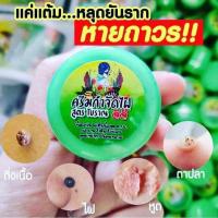 ราคา แต้มไฝ ขี้แมลงวัน หูดตาปลาและติ่งเนื้อ ไฝ ครีมไฝ ทาไฝ จี้ไฝ แต้มขี้แมลงวัน (20286996475)