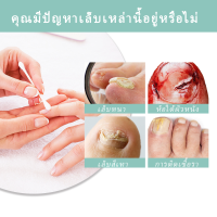 ราคา ยาเชื้อราเล็บ เชื้อราที่เล็บ ยารักษาเล็บ บำรุงเล็บ ครีมบำรุงเล็บ ยารักษาเชื้อราที่เล็บ (21992042783)