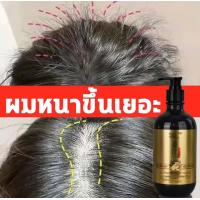 ราคา H e f u แชมพูลดผมร่วง แชมพูเร่งผมยาว แชมพูขิงเพียว ยาสระผมแก้ร่วง แชมพูสระผม ยาสระผมลดผมร่วง ยาสระผมแก สูตรแก้ปัญหาผมร่วง แชมพูแก้ผมร่วง 500ml (20547264308)