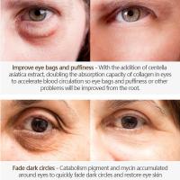 ราคา 7วันเจอผล ครีมลดถุงใต้ตา เมจิกอายครีม eye cream ครีมถุงใต้ตา ครีมทาถุงใต้ตา ถุงใต้ตาบวม ครีมทารอบดวงตา กระชับ ยกกระชับ อายครีมลดใต้ตา 20g (22089639350)