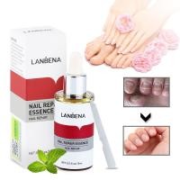 ราคา LANBENA Fungal Nail Repair Serum Treatment Foot Nail Fungus Removal Gel Anti Infection Paronychia Onychomycosis Essence Care (16511906031)