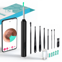 ราคา 800000w พิกเซลที่แคะหู ไม้แคะหูอัจฉริยะ ไม้แคะหู มีไฟ สำหรับส่องรูหู แคะหู ไม้แคะหู ไม้แคะหูมีกล้อง ชุดแคะหู ไม้แคะหูไร้สาย อุปกรณ์แคะหู กล้องจุล (21836337191)