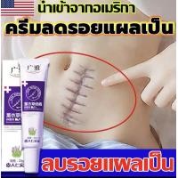 ราคา GUANGYA แนะนำจากหมอ 20g ครีมลบแผลเป็น ครีมลดรอยแผลเป็นลดแผลไฟไหม้แผลน้ำร้อนลวกแผลผ่าตัดเป็นต้นแผลเป็นหลายประเภทยาลบลอยแผลเป็นครีมลดแผลเป็น ยารักษาแผลเป็น ยาทาแผลเป็นนูน ครีมรักษาแผลเป็น ครีมทาแผลเป็น