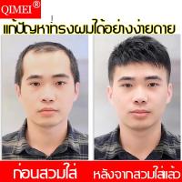 ราคา คุณภาพดี ผมปลอม เบาและระบายอากาศ เสริมปริมาณจำนวนเส้นผม ดูเหมือนตัวจริง วิกผมผู้ชาย วิกผมปลอม วิกผมสำหรับผู้ชาย วิกผมชาย วิกผมชายสั้น ชายวิกผมผู้ชายวิกผม วิกผมสั้นผู้ชาย วิกผมสั้นผู้ชาย ผมจริงวิกผมสั