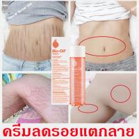 ราคา ครีมทาท้อง ครีมลดรอยแตกลาย กันท้องลาย รองรับการขยายตัวของผิวขณะตั้งครรภ์ ลดผิวแตกลาย แก้แตกลาย ครีมทาแตกลายครีมทารอยแตกขาครีมกันแตกลายครีมทาท้องลายครีมทารอยแตกครีมรอยเเตกลายครีมทาหลังคลอดครีมแก้แตกลาย