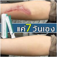 ราคา 3วันเจอผล Breylee รอยแผลเป็น ครีมแผลเป็น ทาแผลคีลอยด์ ลดแผลเป็น ครีมทาแผลผ่าคลอด ลดแผลไฟไหม้ รอยสิว แผลผ่าตัดเป็นต้น Scar cream ครีมลดรอยแผลเป็น 30 กรัม ครีมลบรอยแผลเป็นจากสิว ครีมทาแผลเป็น ขนาด (2230