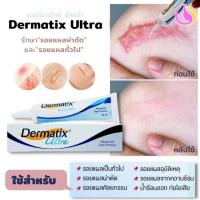 ราคา COD Dermatix15g ของแท้ ลบรอยแผลเป็น ครีมทาแผลเป็น ครีมลดแผลเป็น ยาทาแผลคีลอยด์ ครีมทาแผลผ่าคลอด ลดแผลไฟไหม้ แผลน้ำร้อนลวก แผลผ่าตัดเป ลบรอยแผลเป็นทั้งหมด เท่า ฮีรูดอย แผลเป็น ความสัมพันธ์ ยาทา ครีมลบ