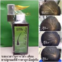 ราคา Neo Hair Lotion ส่งด่วนทุกวัน ของแท้ 100 นีโอแฮร์โลชั่น neohair นีโอแฮร์ แบรนด์แท้ เซรั่มปลูกผม ผมบาง (13212231874)