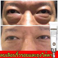 ราคา 7วันเจอผล ครีมบำรุงรอบดวงตา อายครีม ลบถุงใต้ตา ตาบวม ลดความหมองคล้ำ ซ่อมแซมบริเวณรอบดวงตาอย่างล้ำลึก ครีมแก้ขอบตาดำ ครีมทารอบดวงตา (22415280573)
