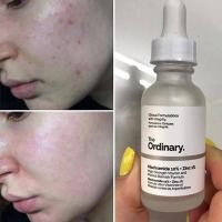 ราคา The Ordinary 10 Niacinamide 1 Zinc Facial Essence ช่วยเรื่องการปรับสีผิวให้สม่ำเสมอ ลบเลือนจุดด่างดำ รอยแผลเป็น และความหมองคล (22677612576)