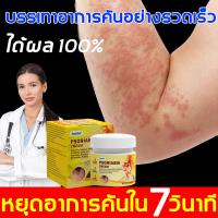 ราคา ยาทาแก้คัน แก้คัน ตุ่มเหงื่อ ผื่นผิวหนัง อับชื้น ผด ครีมทาภายนอก 20ml (22472272573)