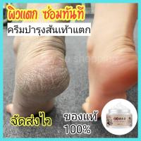 ราคา ครีมทาส้นเท้าแตก เท้าด้าน ครีมทาเท้า ครีมบำรุงเท้า ครีมทาเท้าแตก ครีมทาเท้าแห้ง ครีมทาเท้าด้าน ครีมทาผิว เครื่องสำอาง ครีมบางเบา (17999632831)