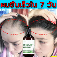 ราคา MEIDU แชมพูแก้ผมร่วง 500ML แชมพูบำรุงผม ป้องกันผมร่วงได้อย่างมีประสิทธิภาพ ปรับปรุงผมบาง บำรุงหนังศีรษะและเส้นผม แชมพูแก้ผมร่วง แชมพูขิงเพียว (22450087995)