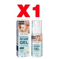 ราคา EELHOE ครีมลบแผลเป็น50ML รักษารอยแผลเป็น แผลผ่าตัด ทาแผลเป็น ทาแผลเป็นนูน ครีมทาแผลเป็น ครีมทารอยแผลเป็น (22458481922)