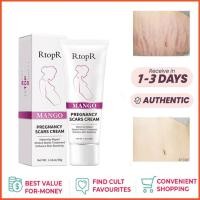 ราคา RtopR FDA มะม่วงครีมบํารุงผิว ลดรอยแผลเป็น รอยแตกลาย ครีมทาท้องลาย ลดรอยแตกลาย ท้องลาย ริ้วรอยจากการตั้งครรภ์ Stretch Mark Cream 40 กรัม (22564173545)