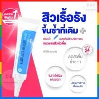 ราคา ครีมบำรุงผิวหน้า ดูแลรักษาสิว เจลแต้มสิว สูตรเร่งด่วน ยุบไว ไม่เป็นคราบ สิวอักเสบ สิวอุดตัน ป้องกันสิว 180บาท (19532737270)