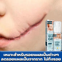 ราคา EELHOE ครีมลบแผลเป็น50ML ของแท้ รักษารอยแผลเป็น แผล ผ่าตัด ทาแผลเป็น ทาแผลเป็นนูน ครีมทาแผลเป็น ครีมทา (22524036894)