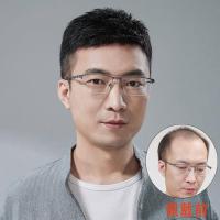 ราคา คุณภาพดี วิกผมผู้ชายผมสั้นจริง ๆ นะครับหัวล้าน และหัวล้าน (21586257480)