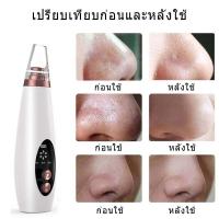 ราคา เครื่องดูดสิวเสี้ยนไฟฟ้า 1274 (6163284607)