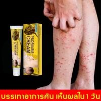 ราคา ยาทาแก้คัน แก้คัน ตุ่มเหงื่อ ผื่นผิวหนัง อับชื้น ผด ครีมทาภายนอก 20g (22587571953)