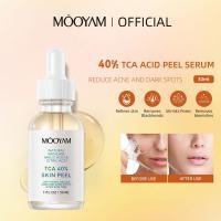 ราคา MOOYAM TCA 40 Skin Peel Serum สาระสำคัญของกรดซิตริก ทำให้หนังกำพร้านุ่มขึ้น ลบสิวหัวดำ เซรั่มบำรุงผิวหน้าควบคุมรูขุมขนและปรับผิวให้เรียบเนียน เอสเซนส์แก้ไขจุดด่างดำ (22663937922)