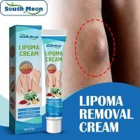 ราคา Zwma Lipoma ดั้งเดิมครีมบำรุงผิวไลโปไลซิสกำจัดเนื้องอกผิวหนังบวมขี้ผึ้งทาแก้ปวดพลาสเตอร์บรรเทาผลัดเซลล์ผิว (18077536220)