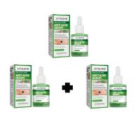 ราคา ซื้อ 1 แถม 1 ครีมแต้มสิว 30ml ละลายหัวสิว ไม่อุดตันผิว รูขุมขนกระชับ อ่อนโยนไม่ระคายเคือง (22497845770)