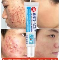 ราคา Anti Acne Cream Acne Treatment Gel Pimple Scars Remover Skin Care Repair Comedone Pimple 30g (19776458974)