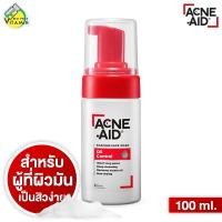 ราคา Acne Aid Foaming Face Wash Oil Control แอคเน่ เอด โฟมมิ่ง เฟซ วอช ออยล์ คอนโทรล 100 ml โฟมล้างหน้า (22588484734)