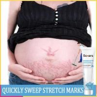 ราคา ครีมป้องกันรอยแตกงาครีมซ่อมแซมกำจัดรอยแผลเป็นจากการตั้งครรภ์ครีมลบเต้านมท้องเอวรอยแตกลายดูแลคลอดบุตร20กรัม (19194103279)