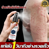 ราคา ครีมลดอาการคัน ทาแก้คัน ผิวหนังทากากเกลื้อน สารสกัดจากพืชใช้ได้ทั้งตัวบอกลาผิวคันได้ง่ายๆ ยาทาสะเกิดเงิน ลาก ผื่น คัน เชื้อรา ผิวหนังอักเสบ ต่อต้านแบคทีเรีย ยาทาสะเกิดเงิน ไวท์เทนนิ่ง ยาทาสะเกิดเงิน ส