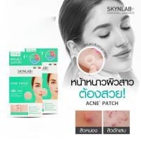 ราคา A 7 1 3 แผ่นแปะดูดซับสิว10ชิ้น ซอง SKYNLAB (22155133075)