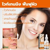 ราคา ครีมทาฝ้า ครีม แก้ ฝ้า กระ e ทาฝ้าของแท้ ครีมทาฝ้าหนาๆๆ 30ml ครีมกำจัดฝ้าวิตามินซี ครัมทาฝ้ากระ กำจั จุดด่างดำ กระ ให้ผิวขาวขึ้ ให้ความชุ่มชื้นต่อต้านริ้วรอย whitening Freckle Serum (22822429547)