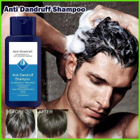 ราคา Shipping from Thailand Nizoral Anti Dandruff Shampoo 200ML Scalp Dandruff (22687852017)