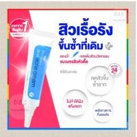ราคา สิวหนอง ครีมแต้มสิว เจลแต้มสิว สิวเสี้ยน สิวอุดตัน สูตรยุบเร็ว (21330247876)