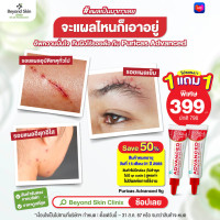 ราคา 1แถม1 หมดอายุ15 01 25 ไม่มีกล่อง Puricas Plus Advanced Dragons Blood C E Scar Gel ขนาด 9 กรัม เจลลดเลือนรอยแผลเป็นทั่วไป (21681928942)